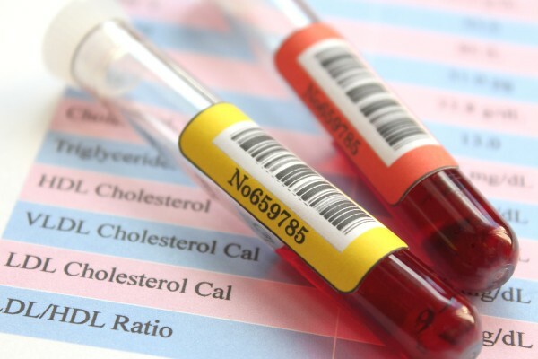 Image representing TESTS & RESULTS